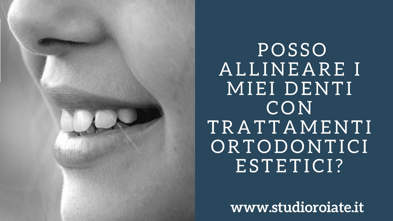 Posso allineare i miei denti con trattamenti ortodontici estetici?